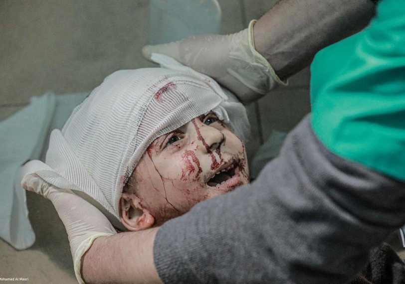 شهداء وجرحى في قصف منازل وتجمعات للمواطنين في قطاع غزة