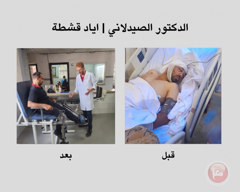 إسراء سعدية: 3 ساعات معلقة من الألم إلى الأمل "قصص ملهمة من قسم العلاج الطبيعي بمستشفى الأمل"