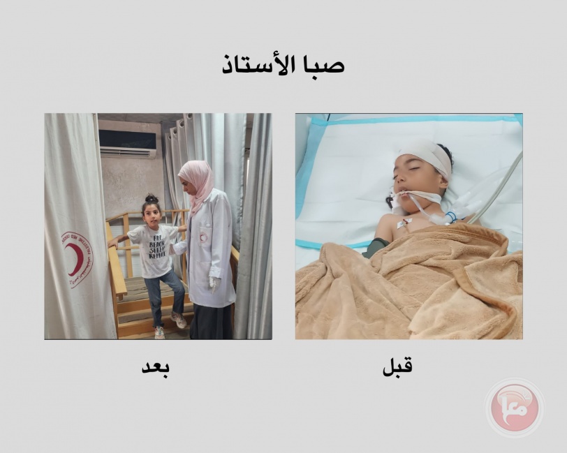 إسراء سعدية: 3 ساعات معلقة من الألم إلى الأمل "قصص ملهمة من قسم العلاج الطبيعي بمستشفى الأمل"