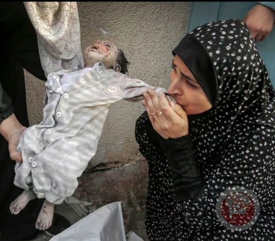 Gaza Health: 43 martyrs in 24 hours and 37,877 since the beginning of the war