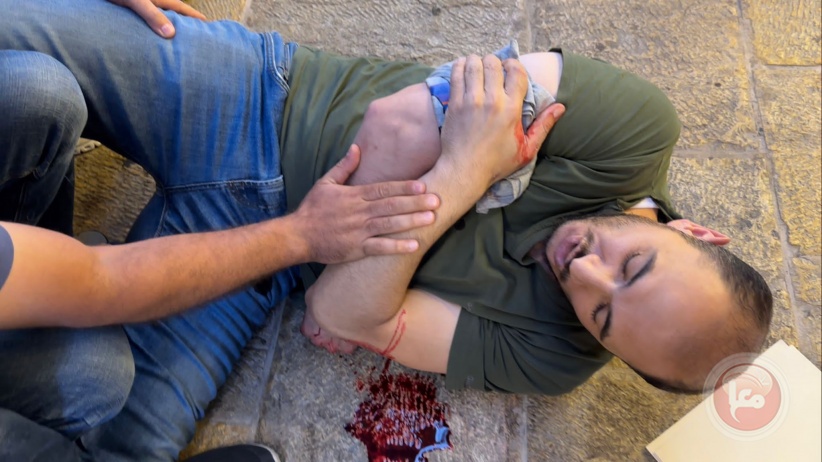 He was shot by a settler and arrested - Jerusalemite merchant Sinan Barakat
