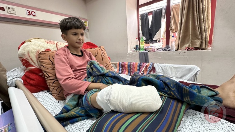 نصفها من الأطفال- 10 آلاف حالة إعاقة في غزة بسبب العدوان
