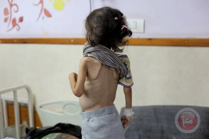 Death toll from malnutrition in Gaza rises to 37 after girl dies